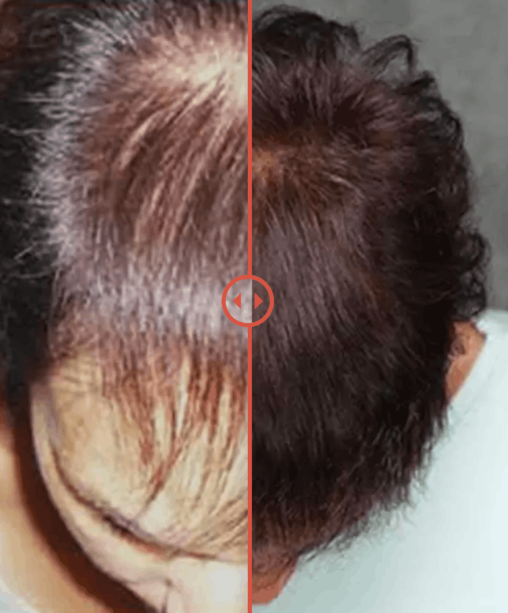 Proven to visibly Reduce Shedding image